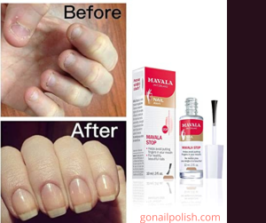 Nail Biting Polish